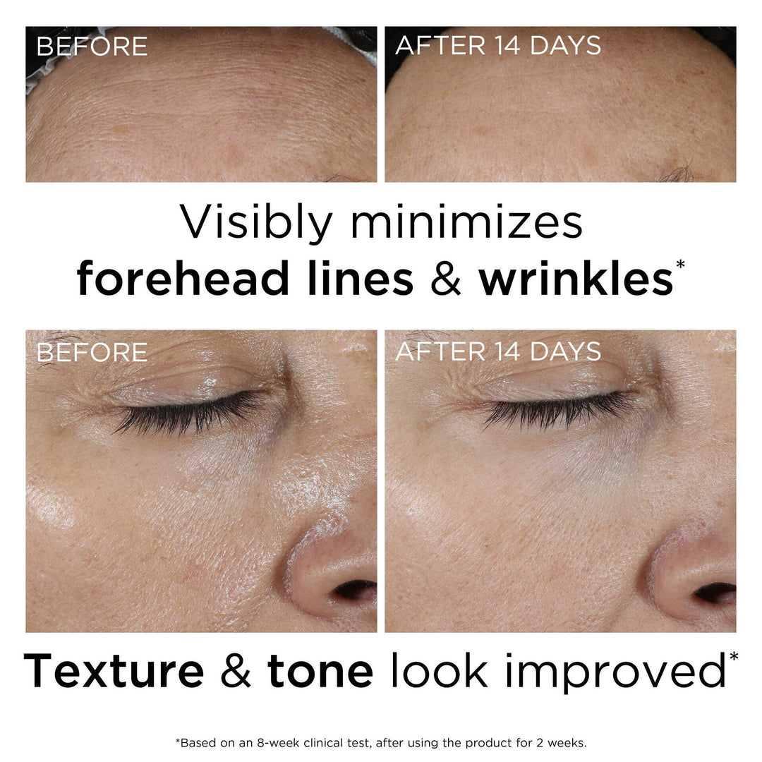 Visibly minimizes forehead lines and wrinkles* Texture and tone look improved* *Based on an 8-week clinical test, after using the product for 2 weeks. 