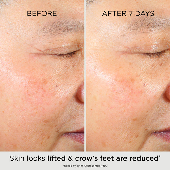 Before and After 7 days, the skin looked lifted and crow's feet are reduced* *Based on an 8-week clinical test.