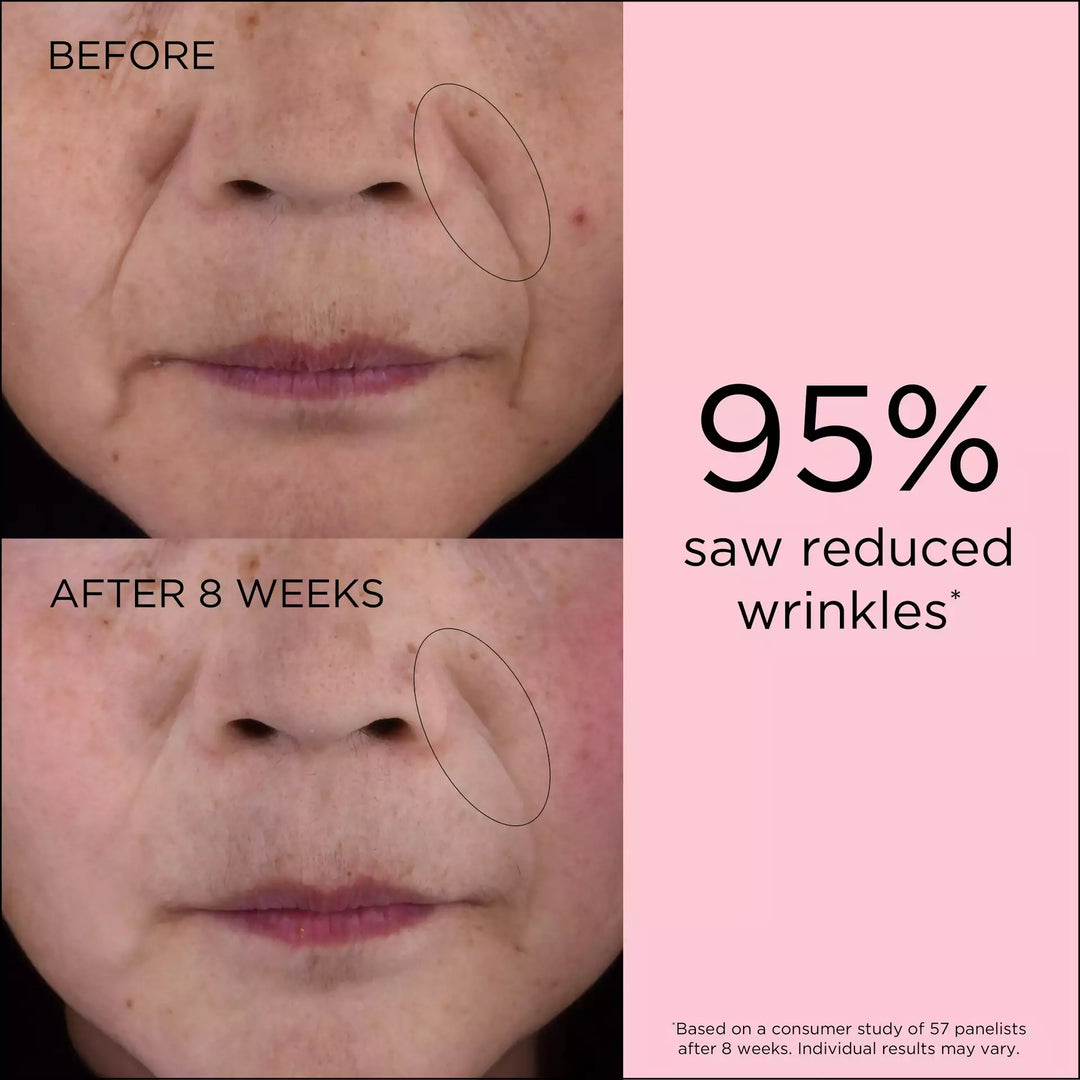 95% saw reduced wrinkles* *Based on a consumer study of 57 panelists after 8 weeks. Individual results may vary