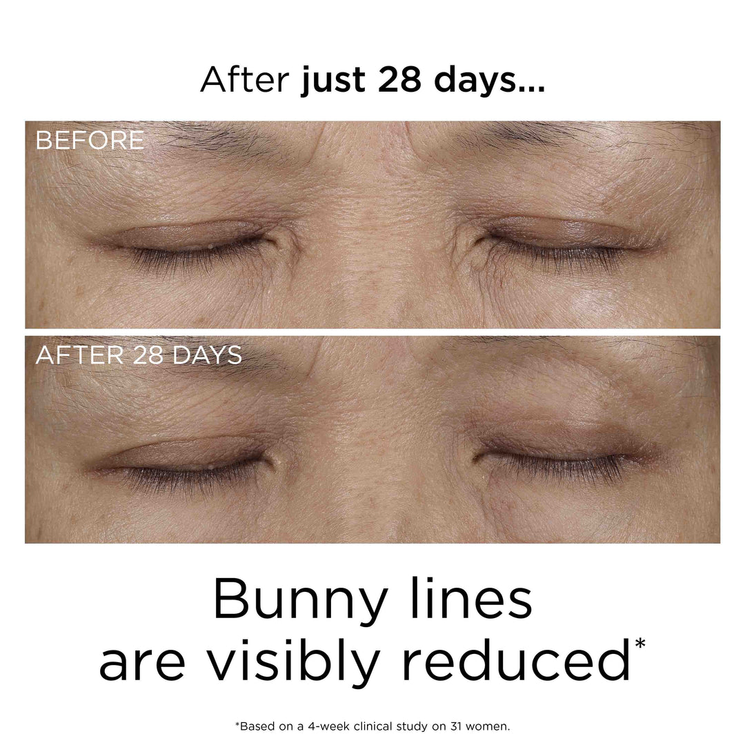 After just 28 days, bunny lines are visibly reduced* *Based on a 4-week clinical study on 31 women.