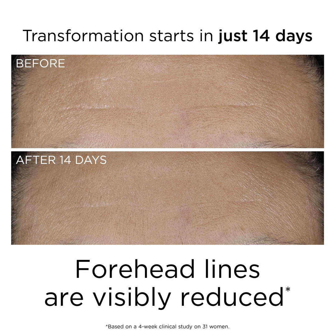 Transformation starts in just 14 days. Forehead lines are visibly reduced* *Based on a 4-week clinical study on 31 women.